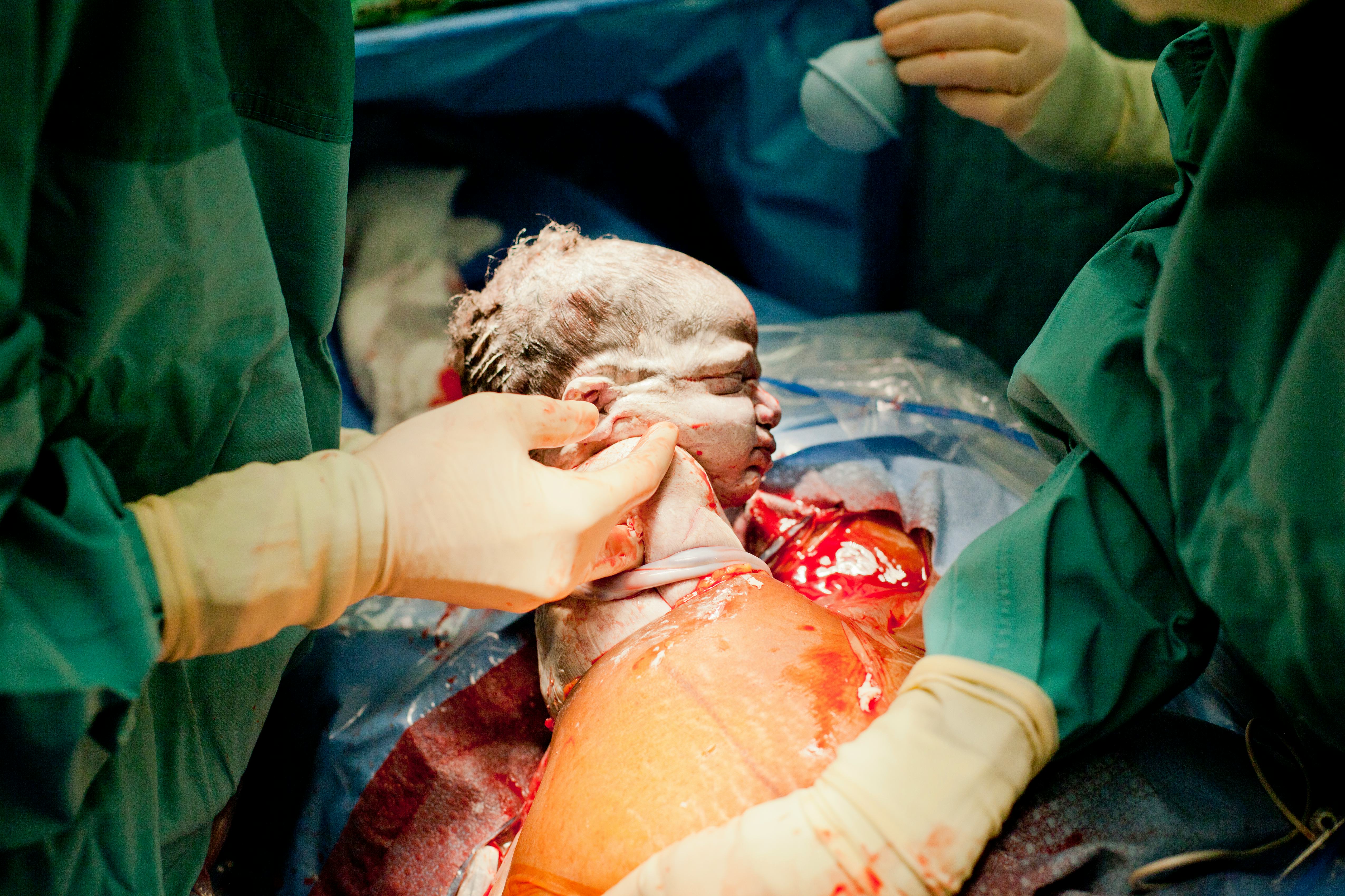 How Experts Would Design A “MomFriendly" Hospital