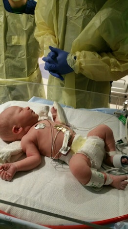 A little baby laying in the doctor's bed while overwatched by doctors