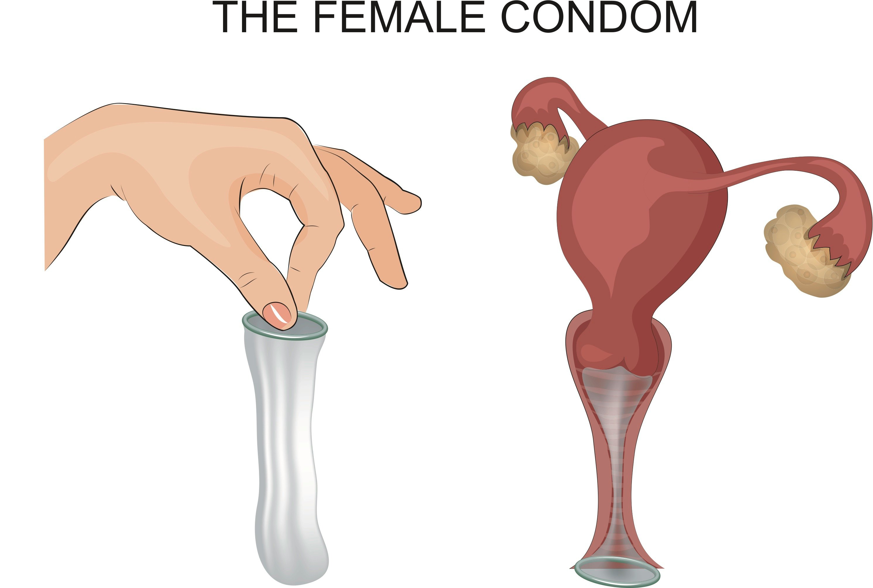 all types of condoms