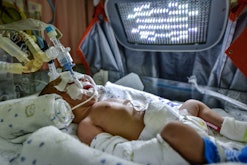 A baby in the NICU with a breathing tube