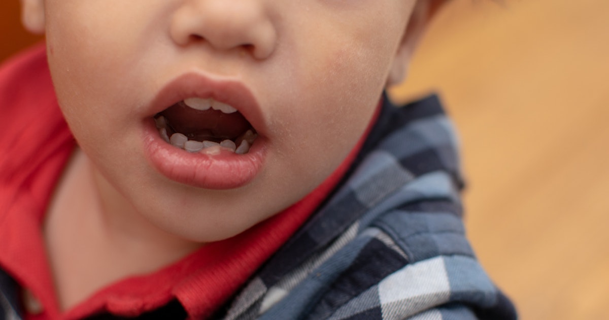 Can Toddlers Get Cold Sores It s More Common Than You Think can-toddlers-get-cold-sores-it-s-more-common-than-you-think