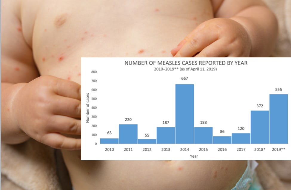 The 2019 Measles Outbreak Is Not Slowing Down & Here Are 5 Examples To ...