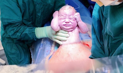 A doctor taking a newborn baby out of mother's body
