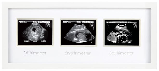 Triple Sonogram Pregnancy Keepsake Frame