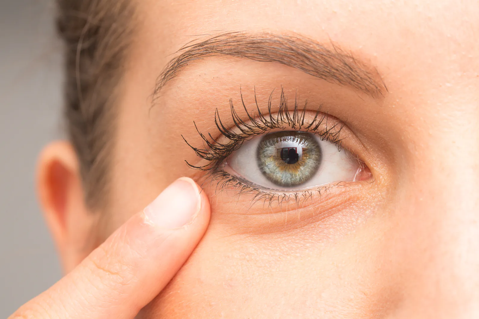 The Home Remedy For Styes That Actually Works, According To Doctors