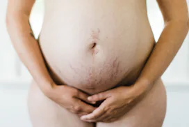 A nude pregnant surrogate holding on to her belly