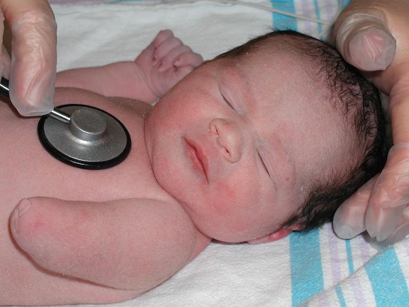 A newborn without a hand