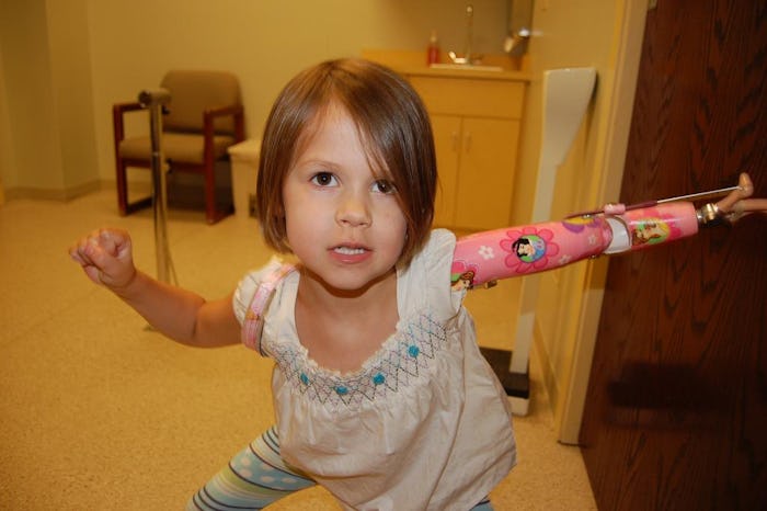 A little girl without a hand playing at home