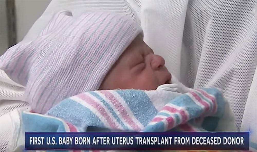 First Baby In The U.S. Born From A Dead Donor’s Transplanted Womb