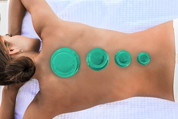 Lure Essentials EDGE Cupping Therapy Set (4 Cups)