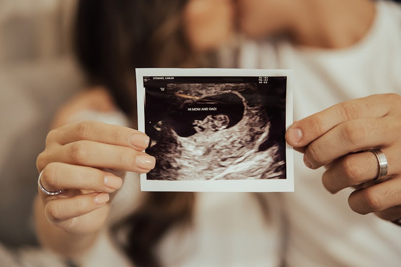 Carlin Bates and partner share a kiss while holding their ultrasound picture