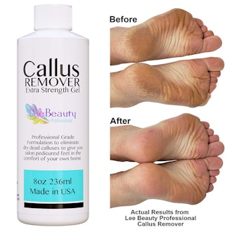 Lee Beauty Professional Callus Remover Gel 