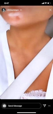Chrissy Teigen zoomed in to show a blemish in her Story 