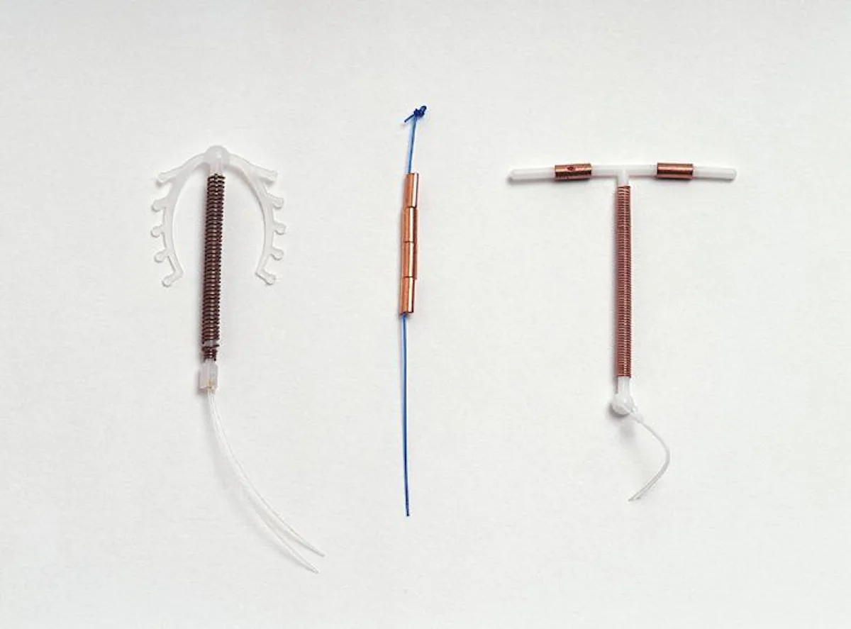 What Does An IUD Insertion Feel Like what-does-an-iud-insertion-feel-like