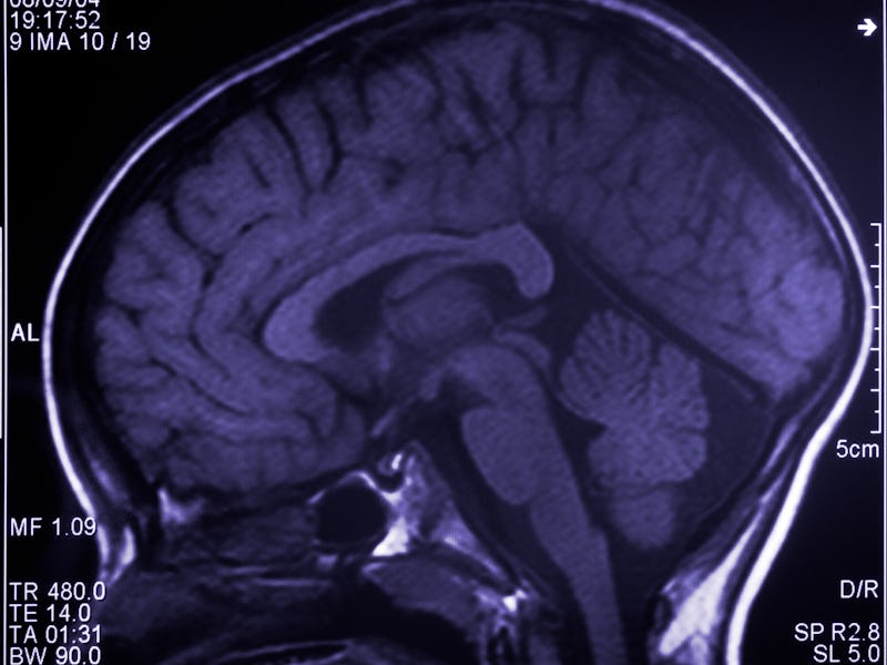 Brain scan.