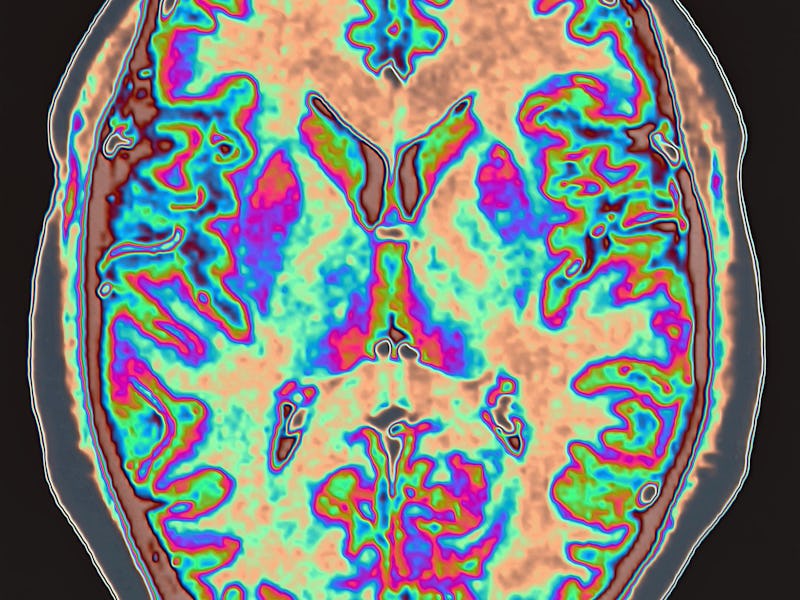 Brain scan.