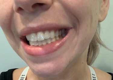 I tried Kendall Jenner's Moon teeth whitening pen, and it didn't cause any sensitivity. 