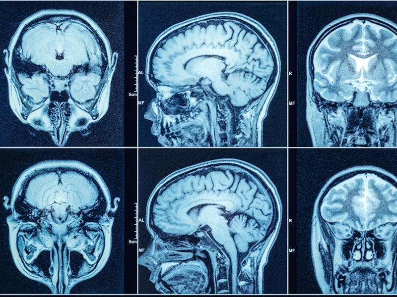 brain scans