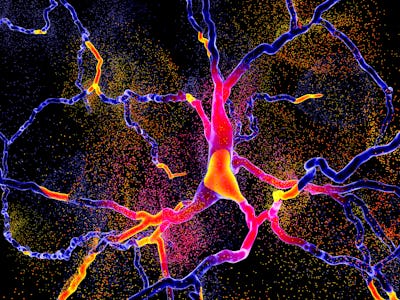 neuron degeneration in parkinson's disease