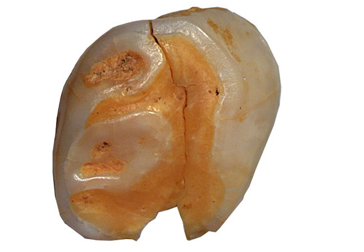Neanderthal baby teeth