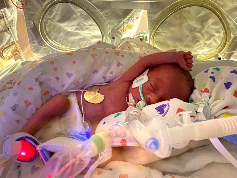 26 week old premature baby in nicu isolette