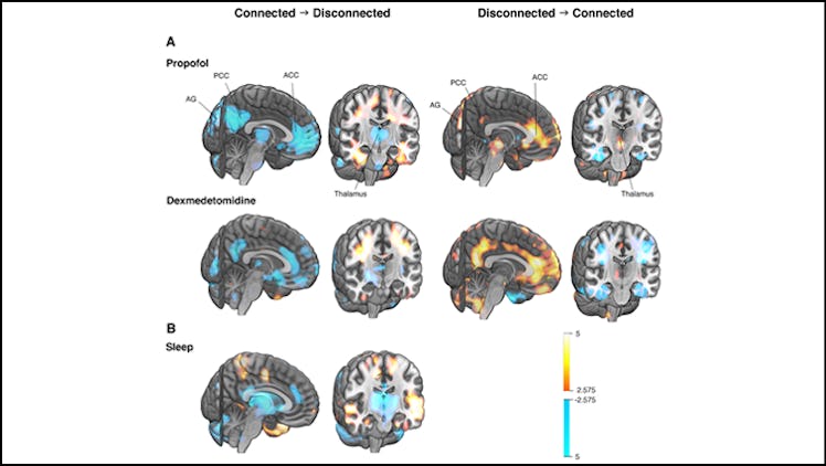 brain scan consciousness