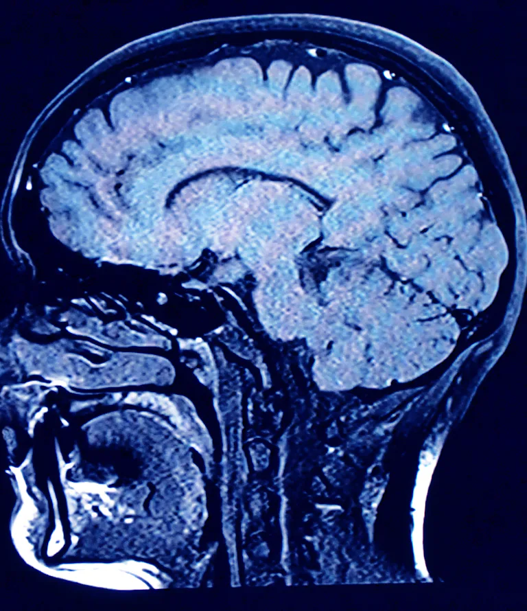 What is the origin of consciousness? Brain network study helps explain