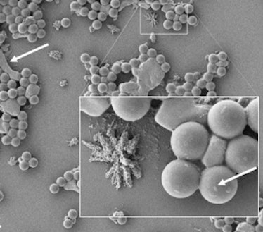 Images from the study's scanning electron microscopy. The left arrow shows microplastic particles em...
