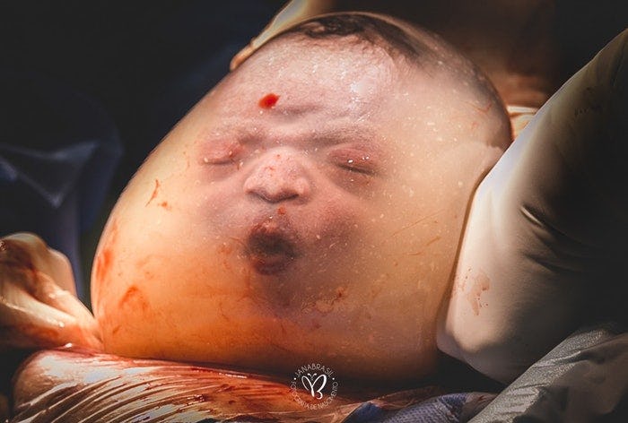 The International Association of Professional Birth Photographers' annual best birth photo competiti...