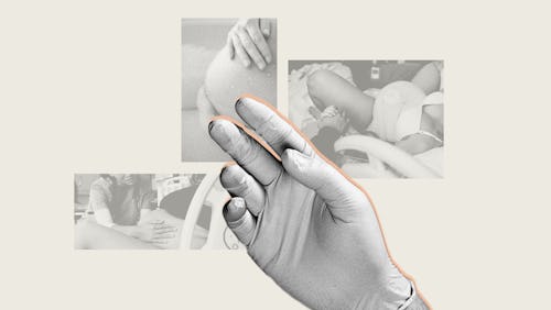 A collage with women getting cervical exams during labor slightly blurred and a hand wearing a rubbe...
