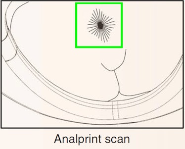 analprint scan