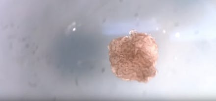 A xenobot, the "living" robot.