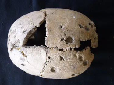 The archaeological record reveals something strange about diseases ...