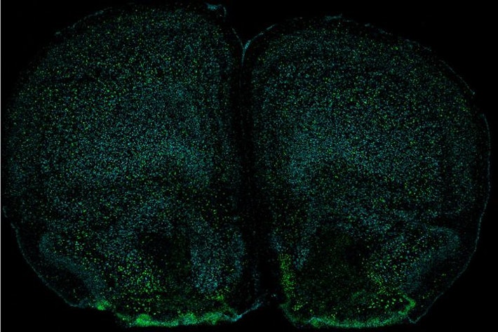 Inverse.com article on connection between stress and the immune system