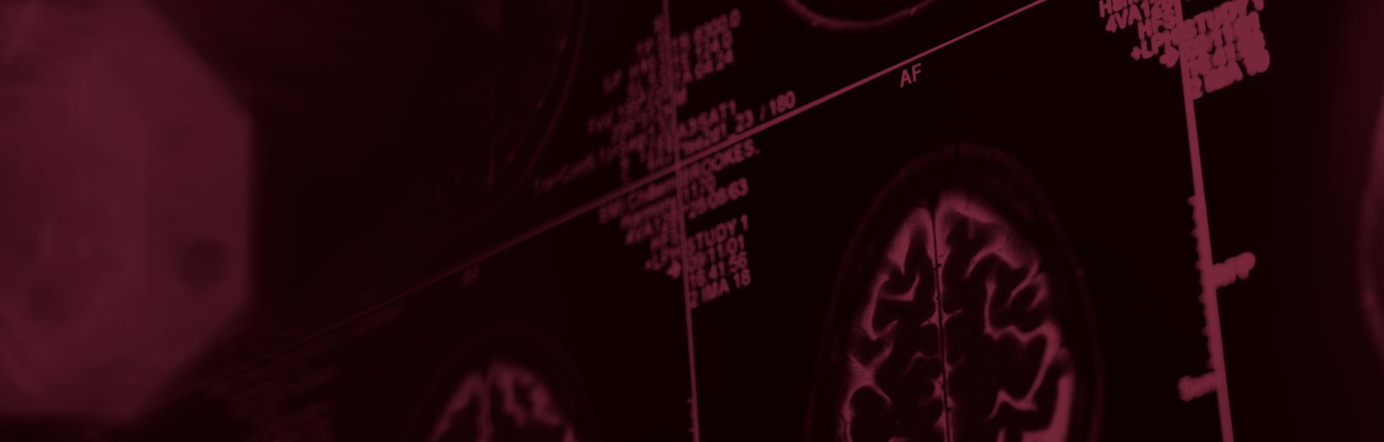 brain scans