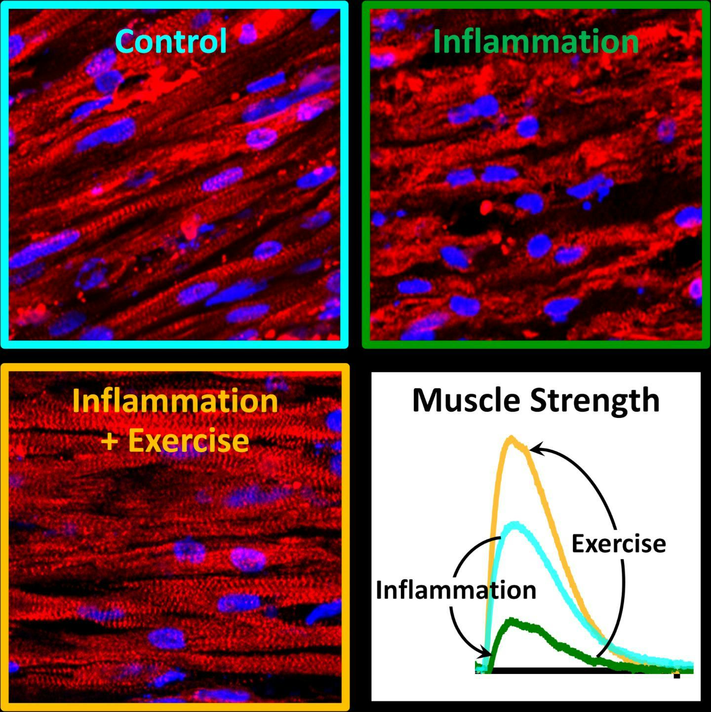 Exercise And Chronic Inflammation: Why Workouts Can Combat Disease