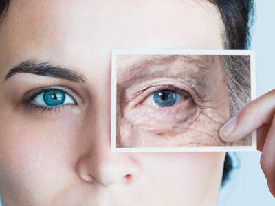 eye aging