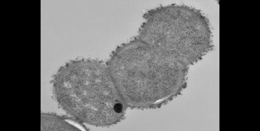 Microscopic view of the gut bacteria Ruminococcus gnavus 