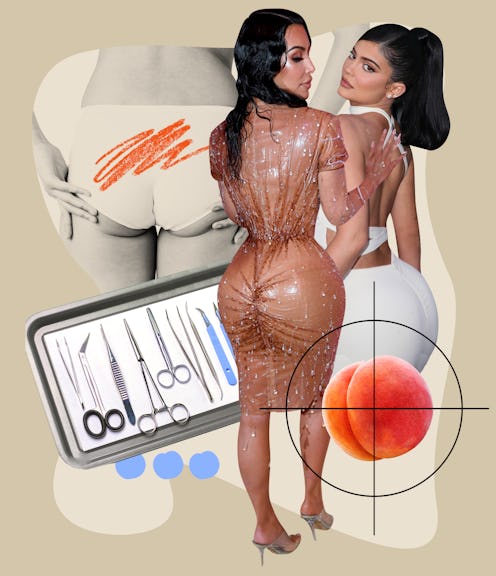 Doctors explain what to expect before, during, and after a Brazilian Butt Lift.