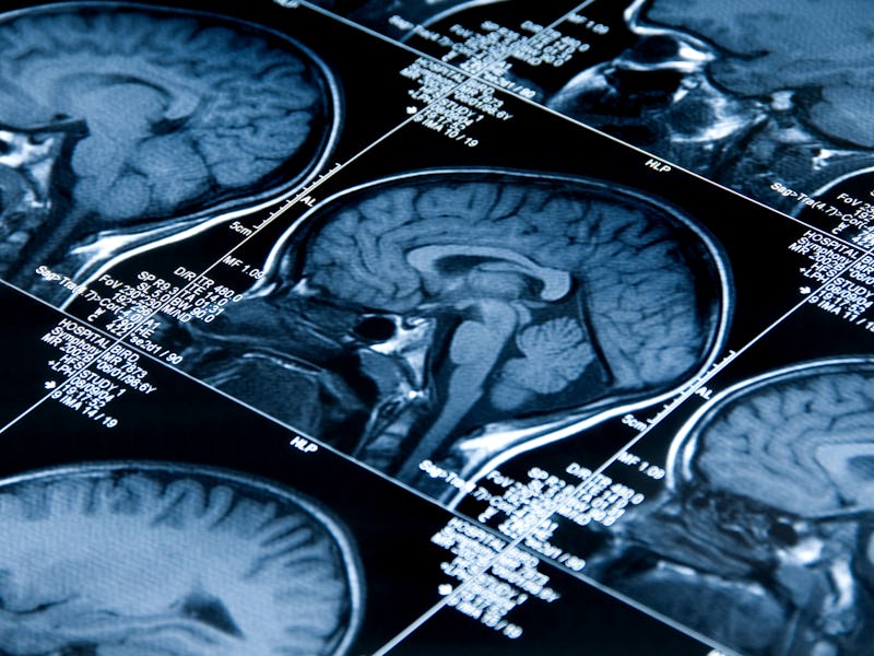 brain scans