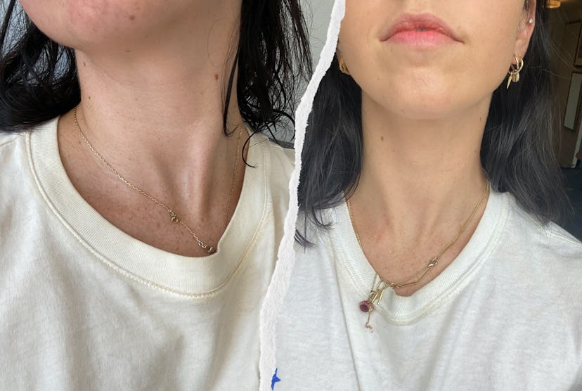 Before and after regular use of SkinMedica’s Neck Correct Cream.