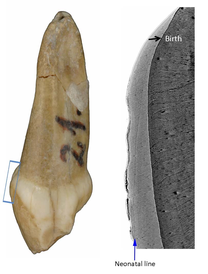 neanderthal milk tooth 