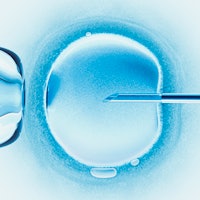 A third of fertility doctors still practice this unproven treatment — study