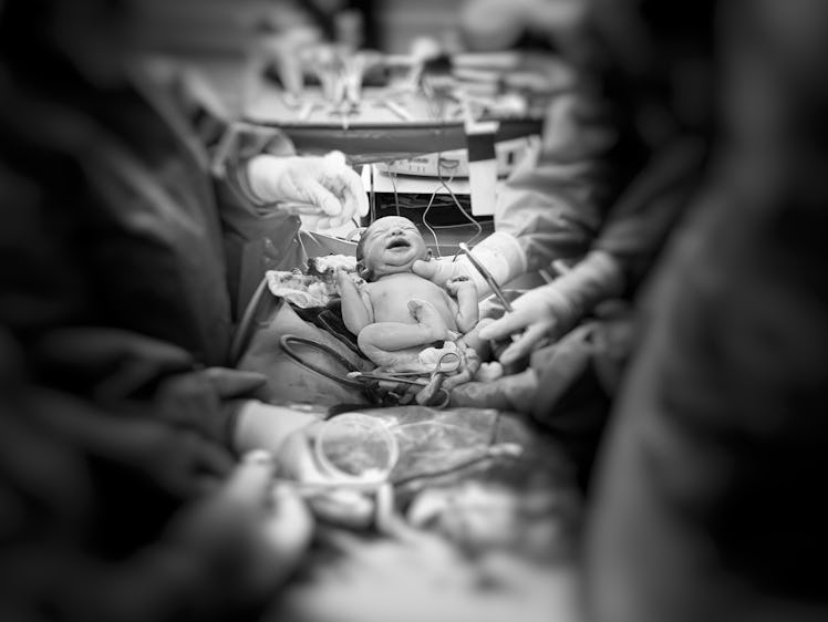 A newborn cries in a delivery room.