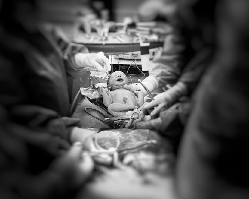 A newborn cries in a delivery room.