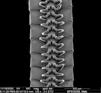 The legs of a male Eumillipes persephone