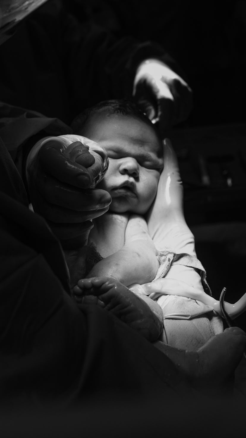 A step to step guide to having a c-section.