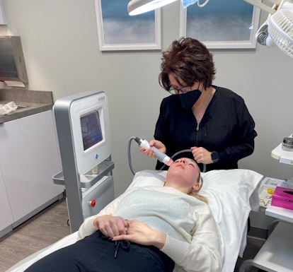 During the Vivace RF Microneedling treatment.