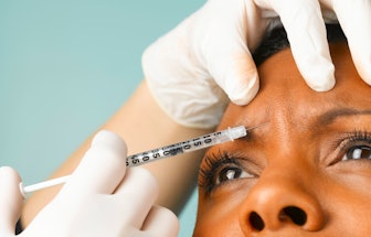 A woman getting Botox injected in her forehead area that could help her anxiety