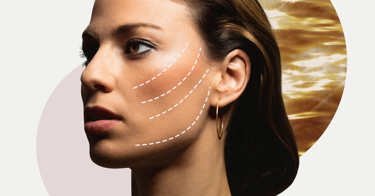 Thread Lifts: What The Pros Want You To Know About The Trendy Procedure